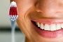 Стоматология – как лечить кариозные зубы